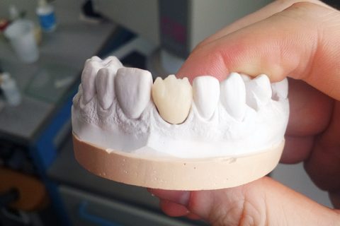 1º Curso Online Prático Labordental