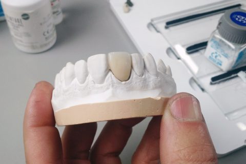 1º Curso Online Prático Labordental