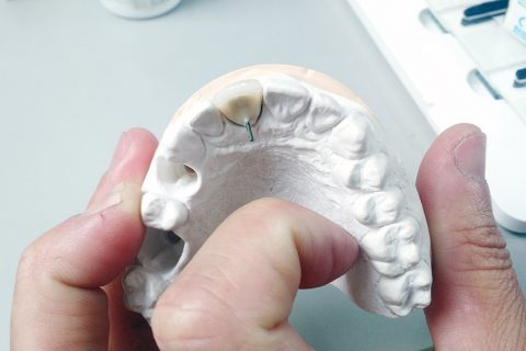 1º Curso Online Prático Labordental