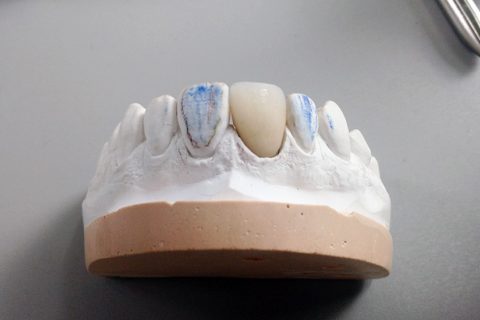 1º Curso Online Prático Labordental