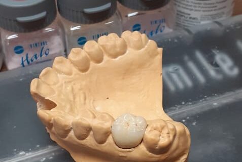 Curso de Metalocerâmica em parceria com a Dental Free de Belo Horizonte