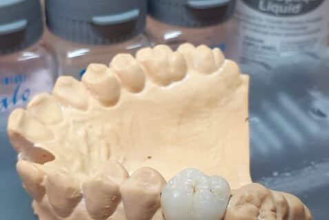 Curso de Metalocerâmica em parceria com a Dental Free de Belo Horizonte