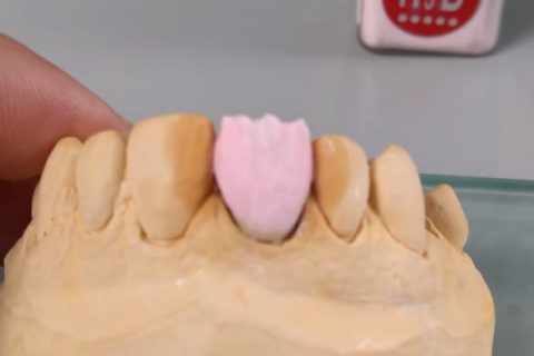 Curso de Metalocerâmica em parceria com a JV Dental