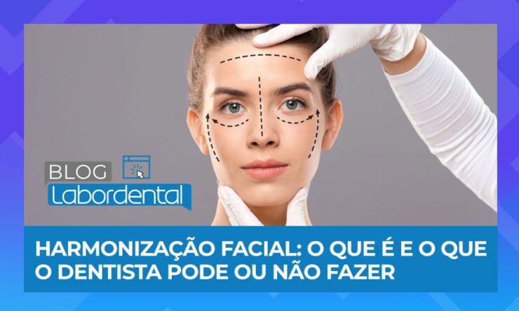 Qual procedimento posso fazer em uma Harmonização Facial?